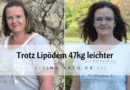 Abnehmen mit Lipödem: 47 kg abgenommen – Mein Weg zu einem leichteren Leben